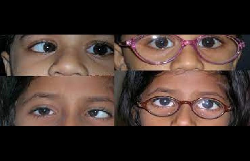 Treatments Sight Vision Eye Care And Lasik Center Surat 